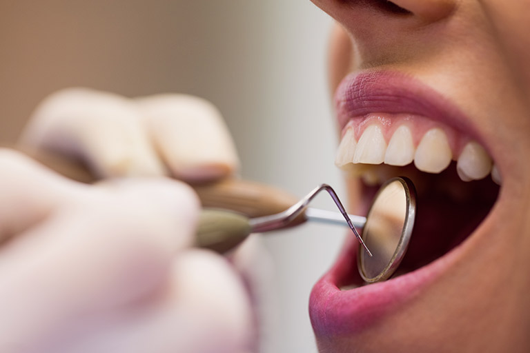 Periodoncia, paciente mujer abriendo la boca en el dentista