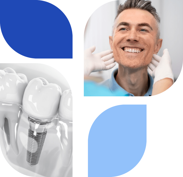 Implantes Dentales Clinica Verona Portada