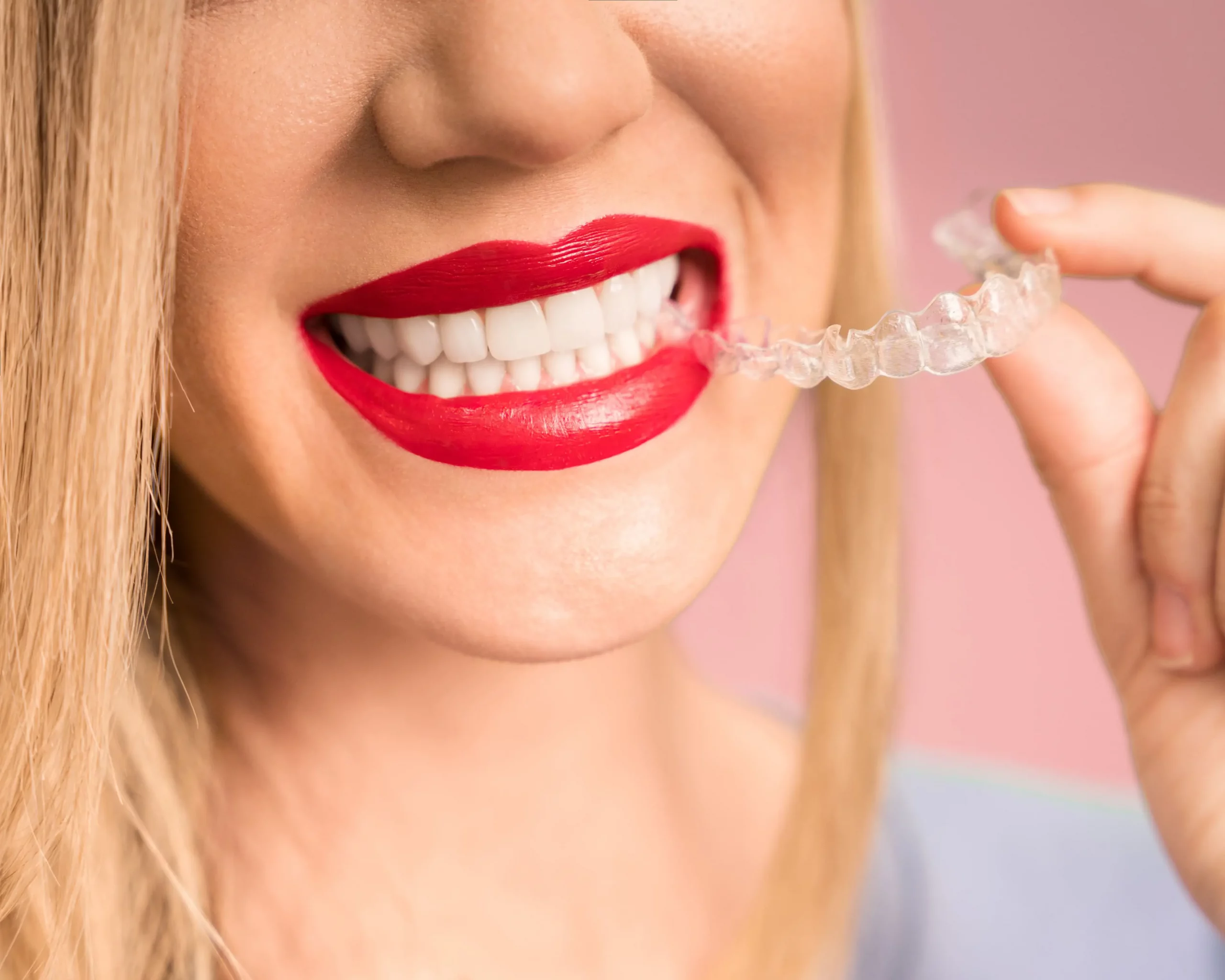 METER DE PORTADA ORTODONCIA scaled